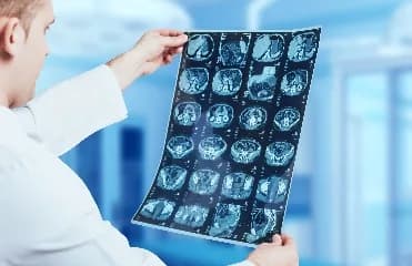 Illustration for MRI
